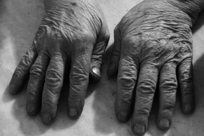 The Impact of Cortisol on Aging