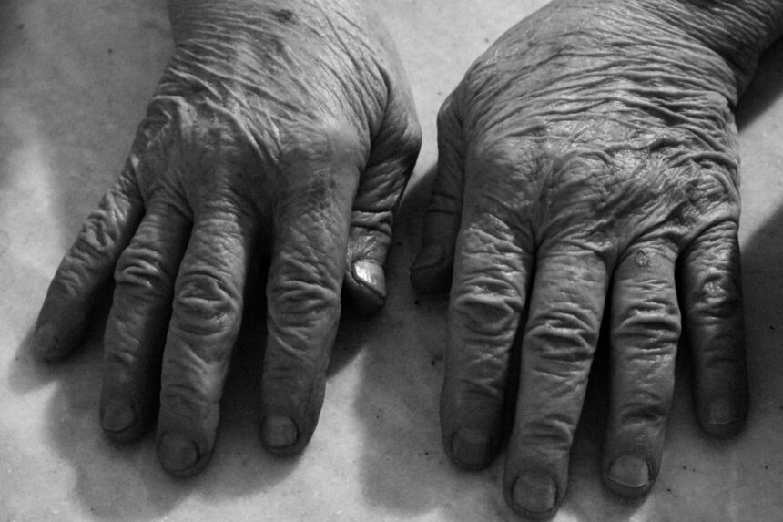 The Impact of Cortisol on Aging
