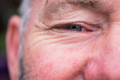 Natural Ways to Reduce Wrinkles