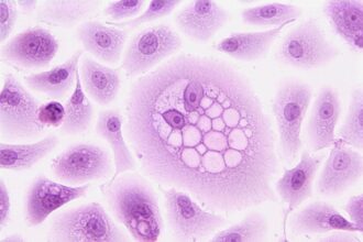 The Impact of Senescent Cells on Aging