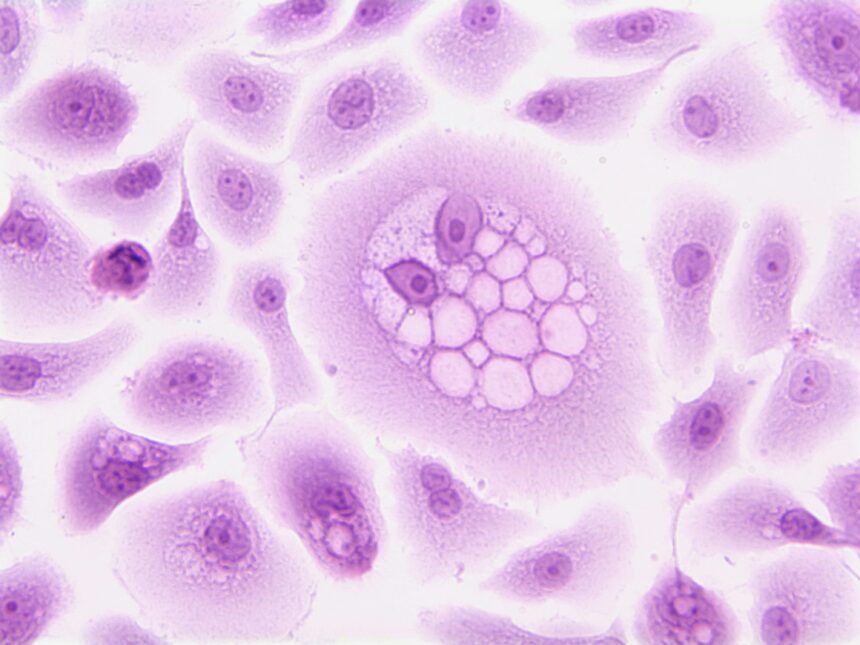 The Impact of Senescent Cells on Aging