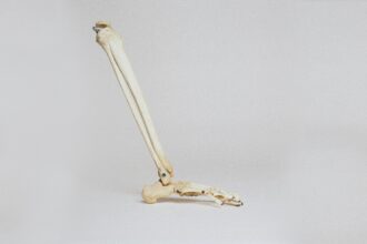 Boost Bone Density with Exercise