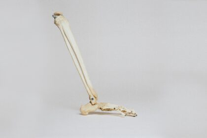 Boost Bone Density with Exercise