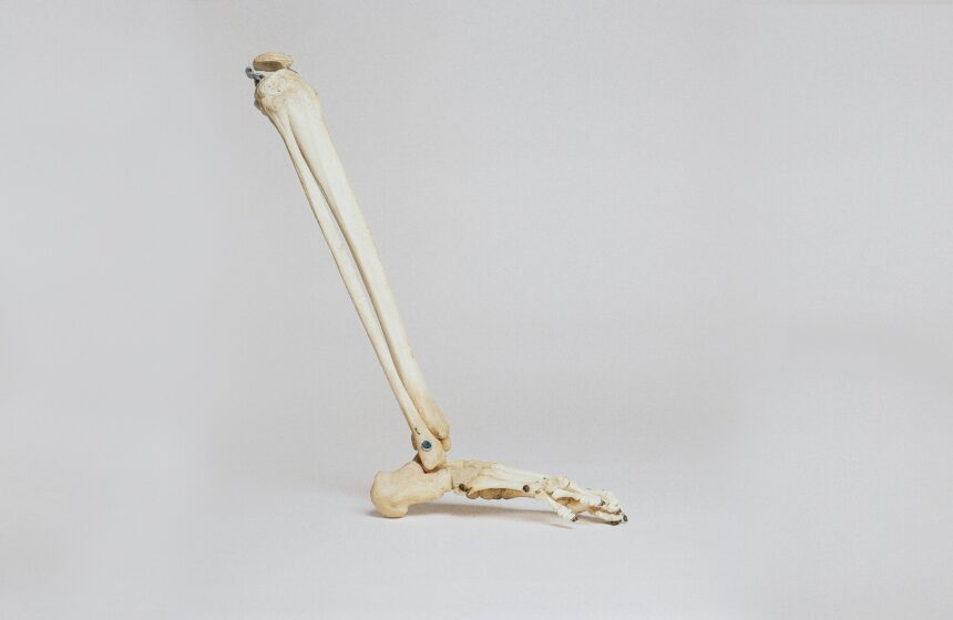 Boost Bone Density with Exercise
