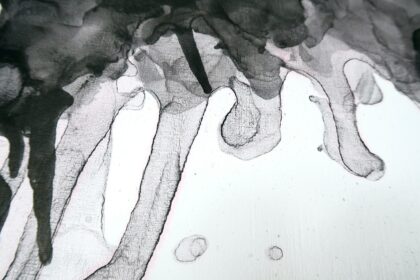 Hormones and Bone Density: Understanding Aging Effects on Bone Health